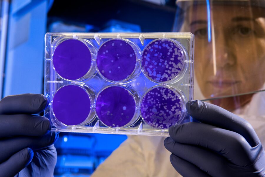 Науковці створили бактерії, які захищають кишечник від побічної дії антибіотиків