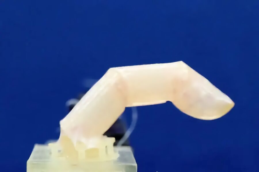 Scientists covered a robot finger in living human skin