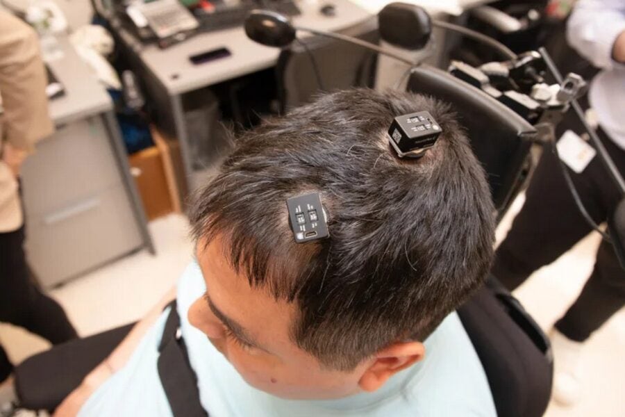 AI-enabled brain implant helps patient regain feeling and movement to a paralyzed patient