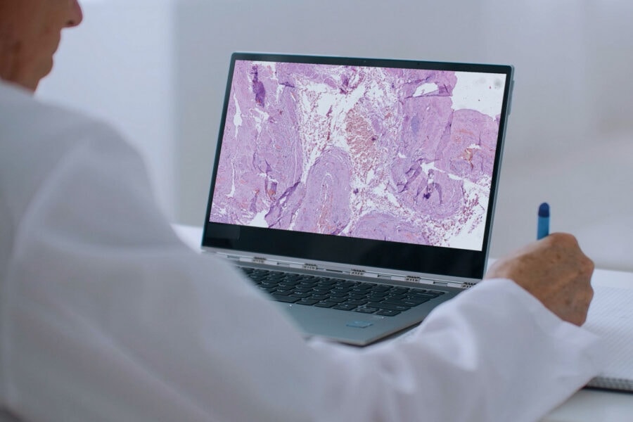 Україна отримала сканер зі ШІ, який допомагатиме в діагностиці раку